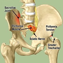 New Treatment for Sacroiliac Joint Conditions 1