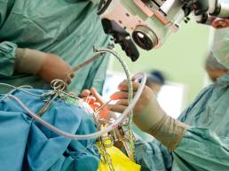 1 Open Brain Surgery and Procedures