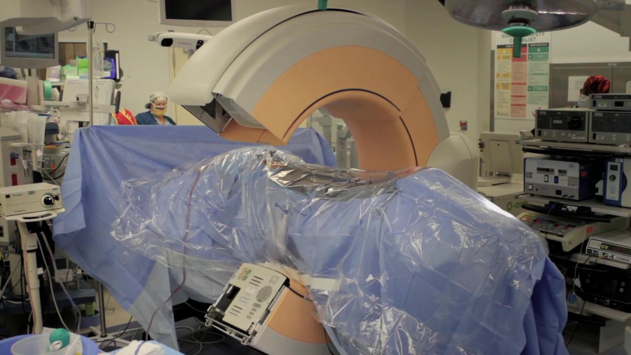 Dr Almubaslat to be the first in Louisiana to perform SI Joint Fusion Surgery using Spinal Neuronavigation