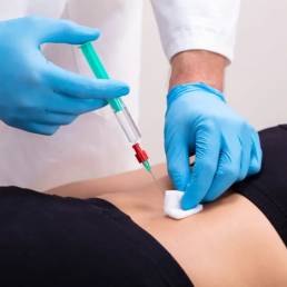 Spinal Steroid and Stem Cell Injection Procedures