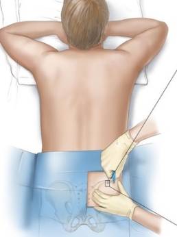 Stem Cell Injections